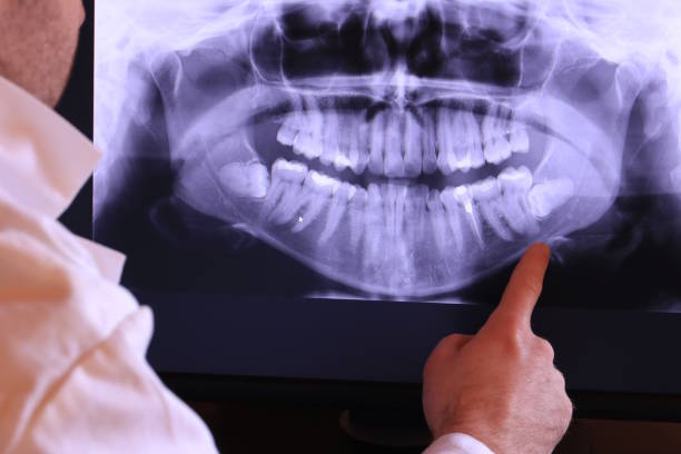 Best Emergency Dentist for Knocked-Out Tooth in South Creek, WA
