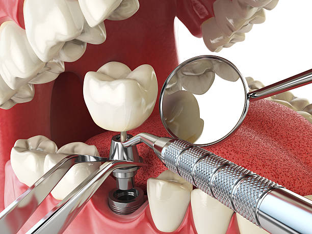 Best Emergency Dental Services for Seniors in South Creek, WA